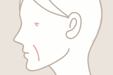 しわ・たるみ治療